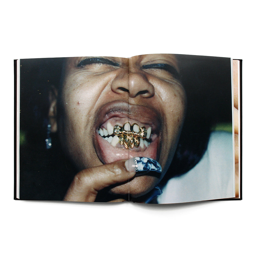 Mouth Full Of Golds