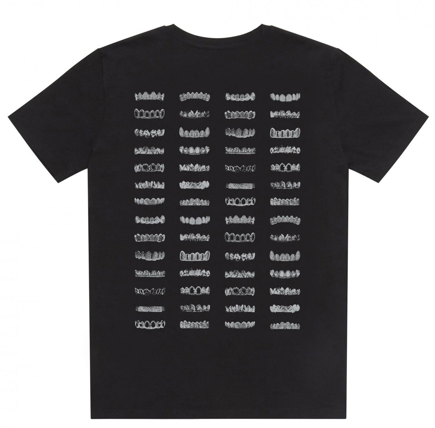 Mouth Full Of Golds BLACK T-Shirt