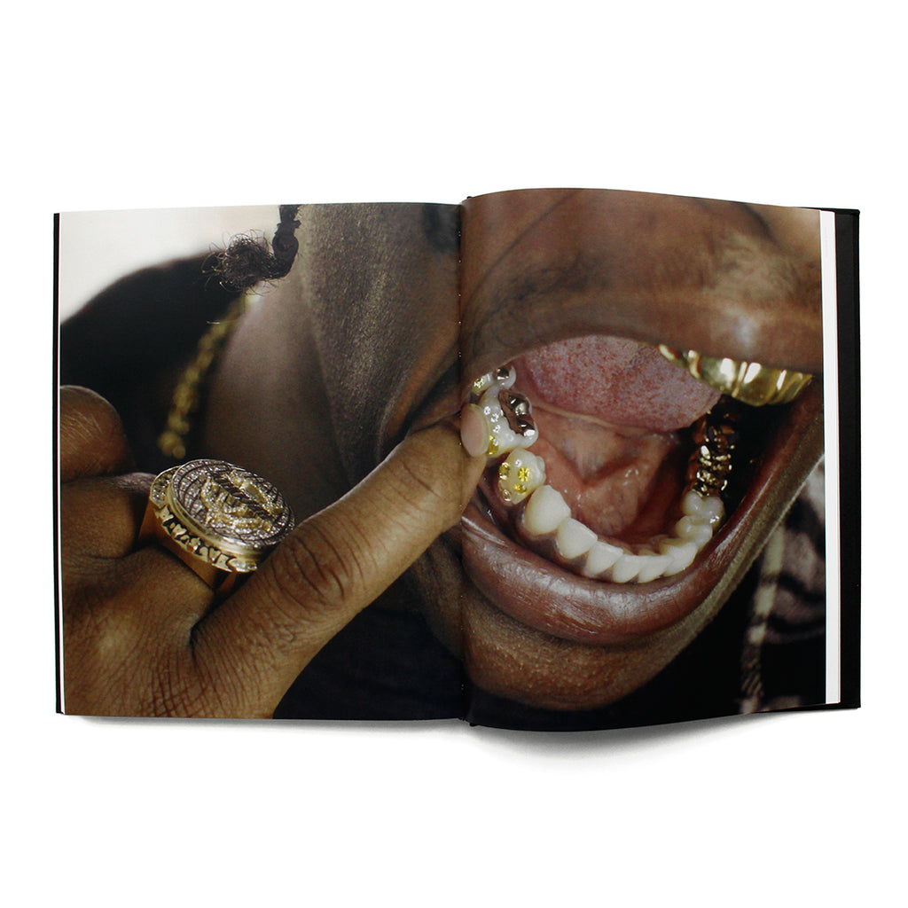 Mouth Full Of Golds