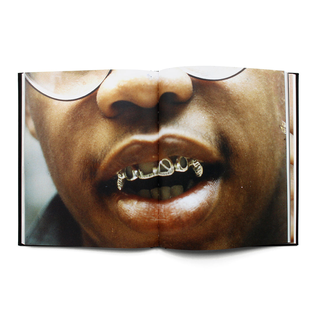 Mouth Full Of Golds