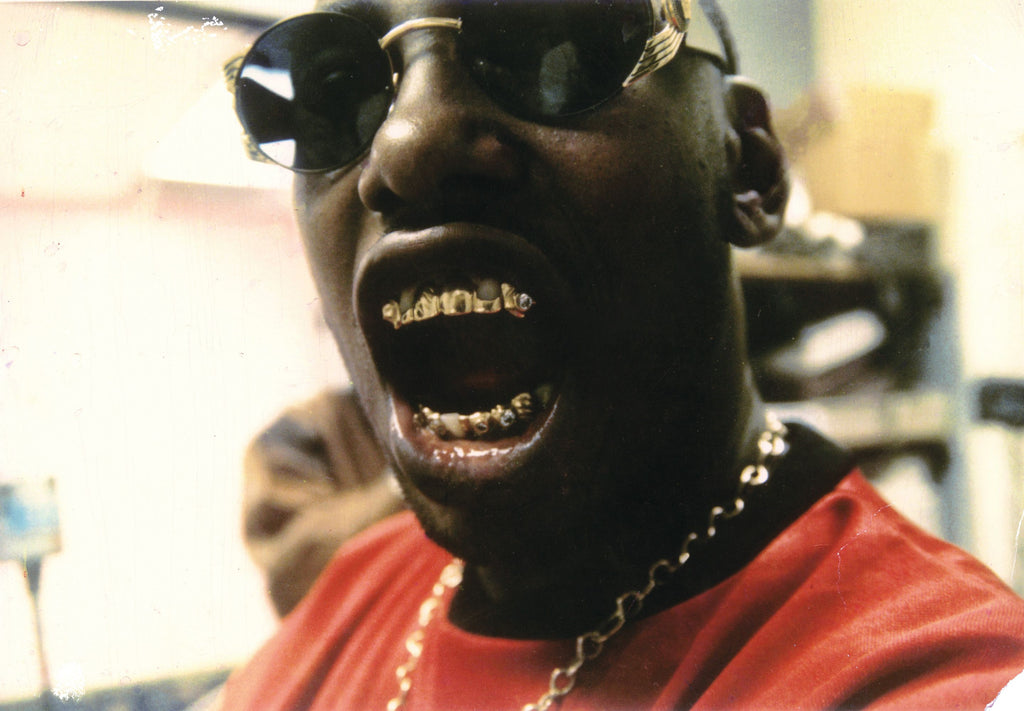 Mouth Full of Golds Re(Edition)