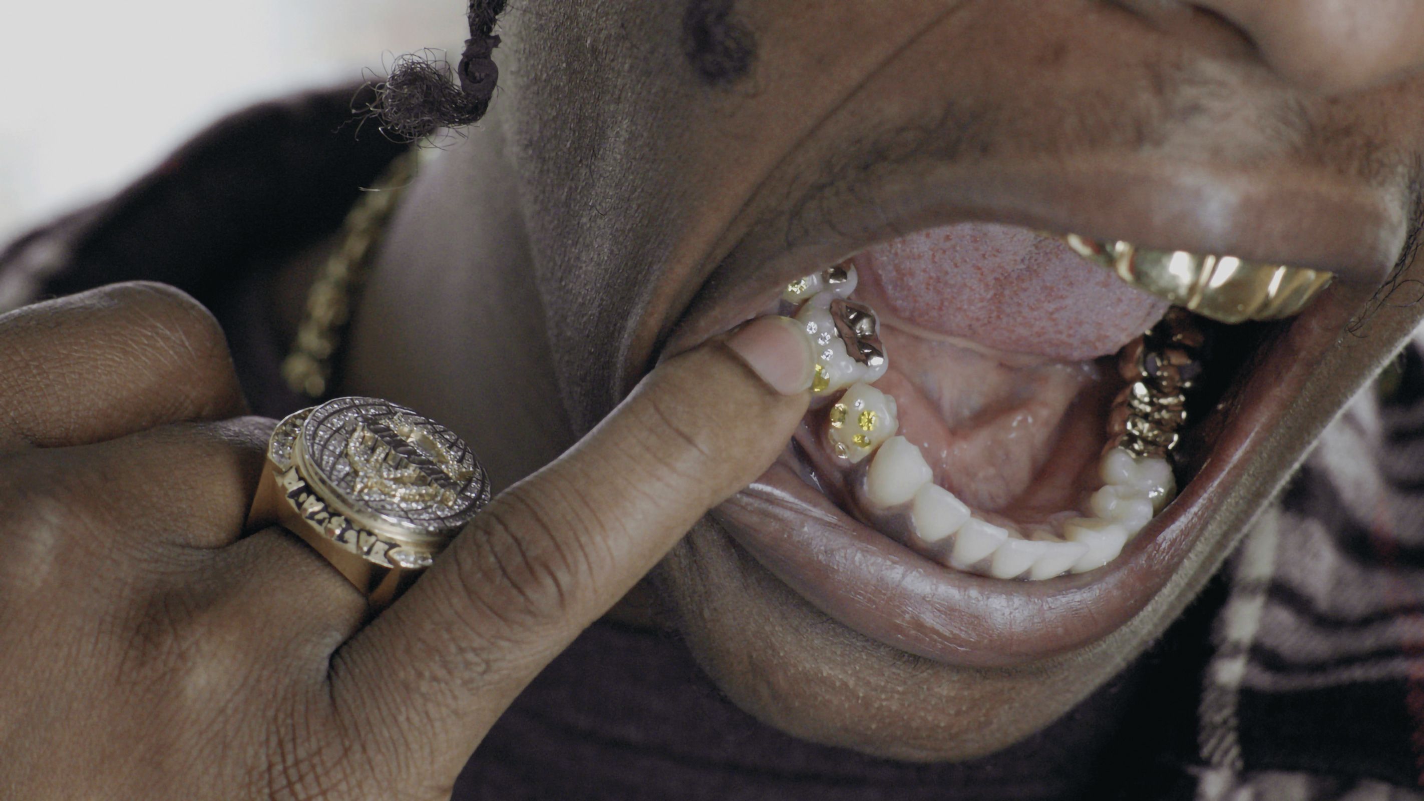 Mouth Full of Golds Re(Edition)